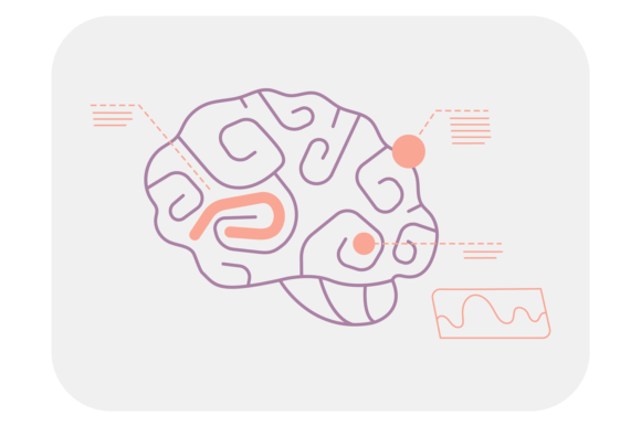 Brain Scan Anatomy Infographic Design